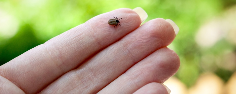 α-GAL综合征在过敏与传染病之间的影响与保护之间的权衡