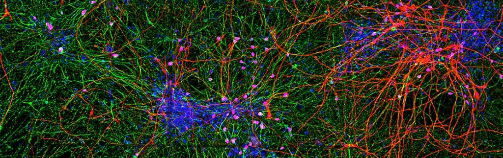 研究大脑和神经系统疾病的神经细胞培养