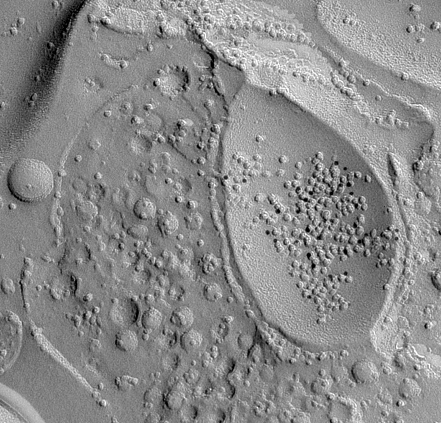 高分辨率免疫电子显微技术显示可能受AD影响的免疫粒子