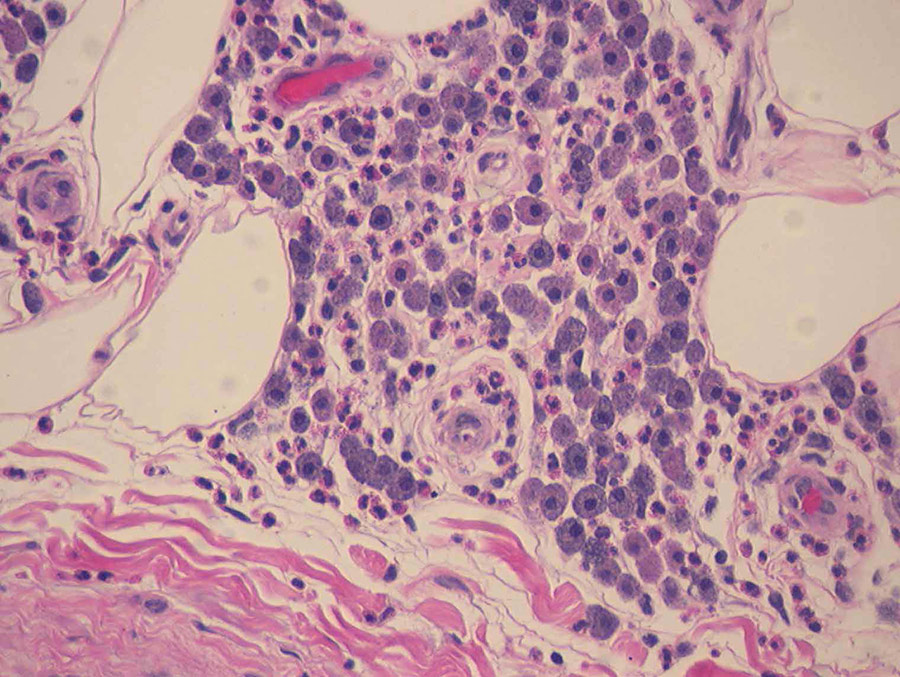 兽医病理学研究疾病,如引起狗皮肤肿瘤的MCTs