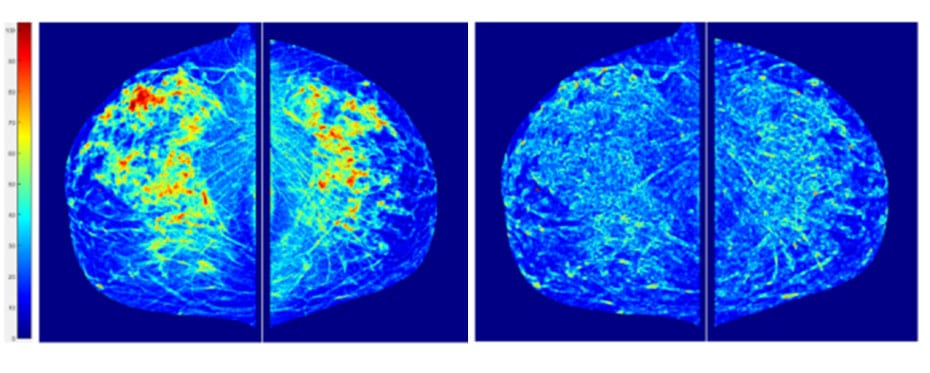 预测癌症风险binzheng研究拓展